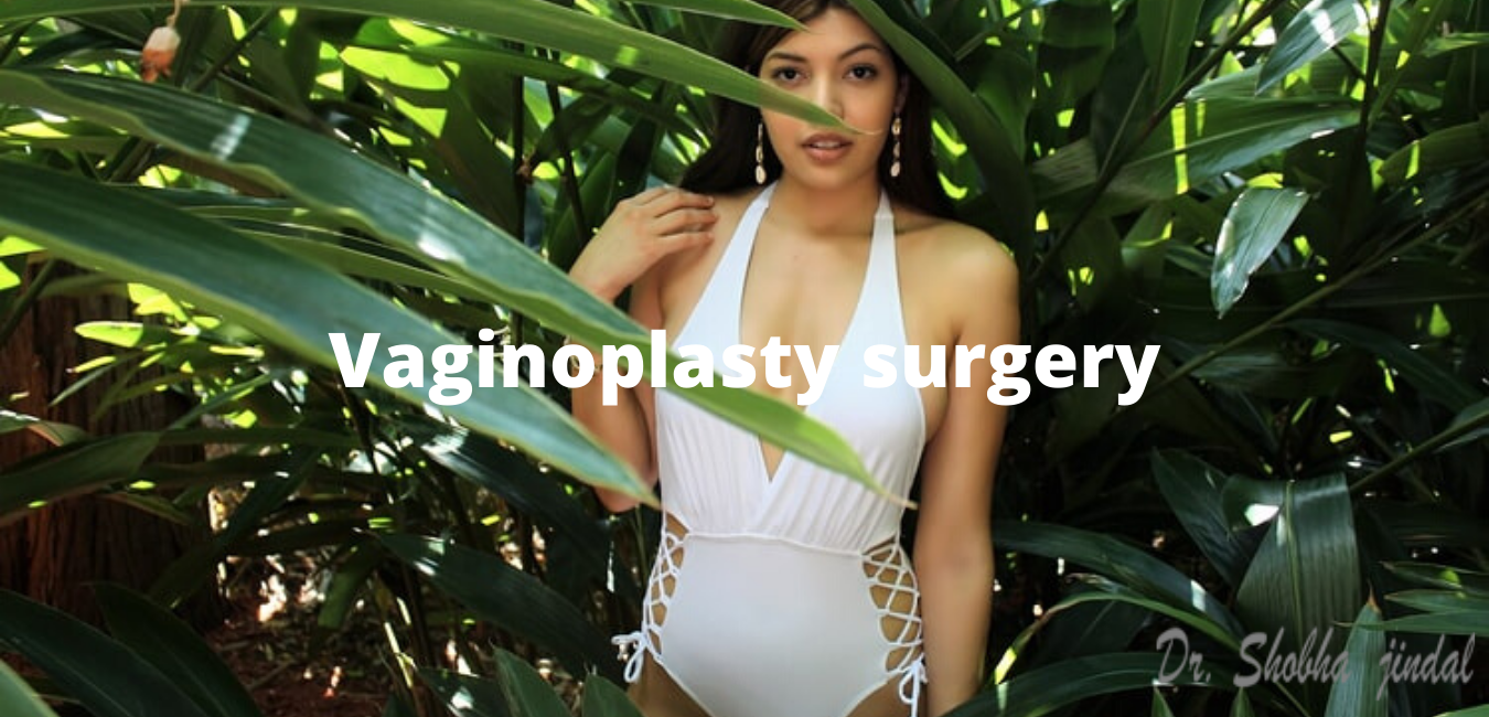 Vaginoplasty surgery in Delhi