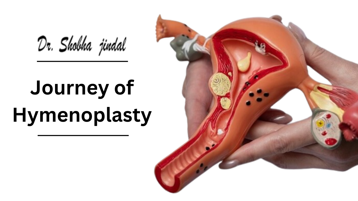 Journey of Hymenoplasty