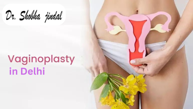 Vaginoplasty in Delhi