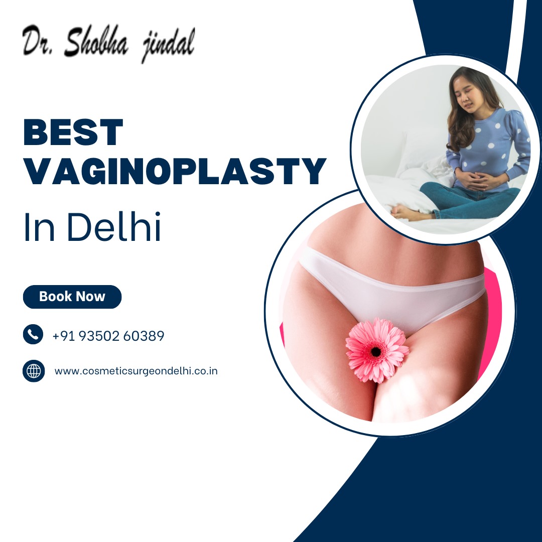 Guide Vaginoplasty