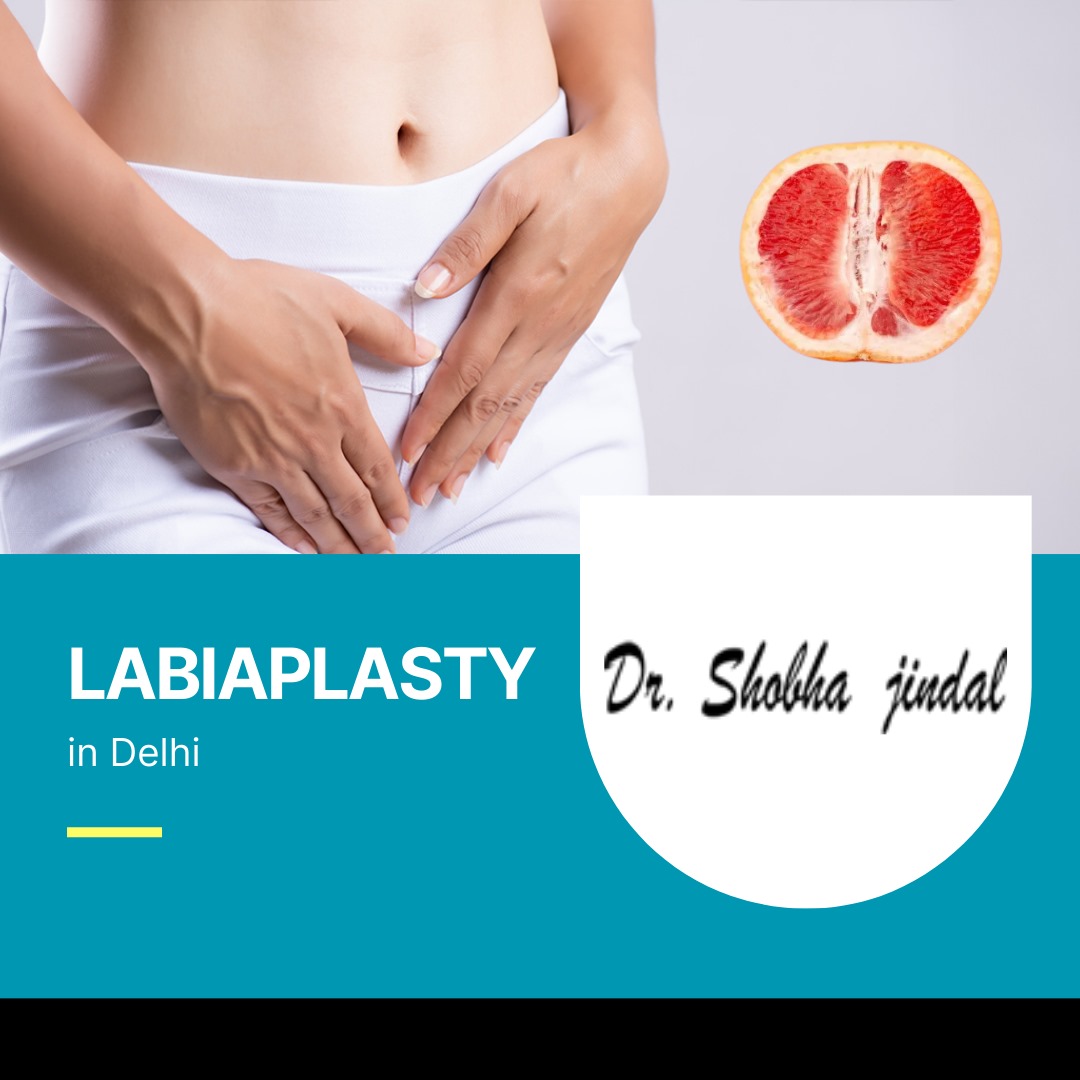 Labiaplasty Surgery