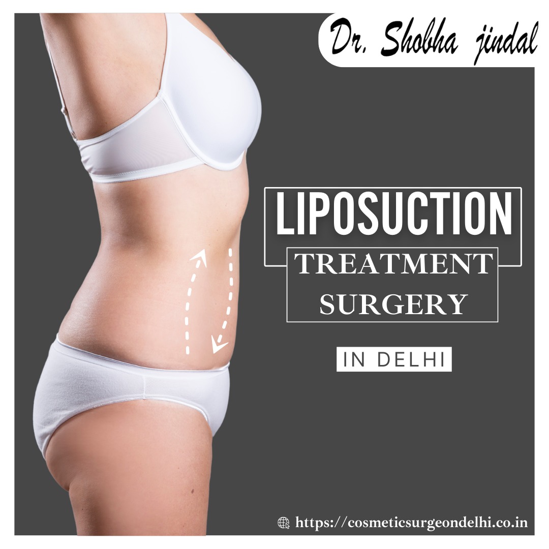 liposuction Treatment