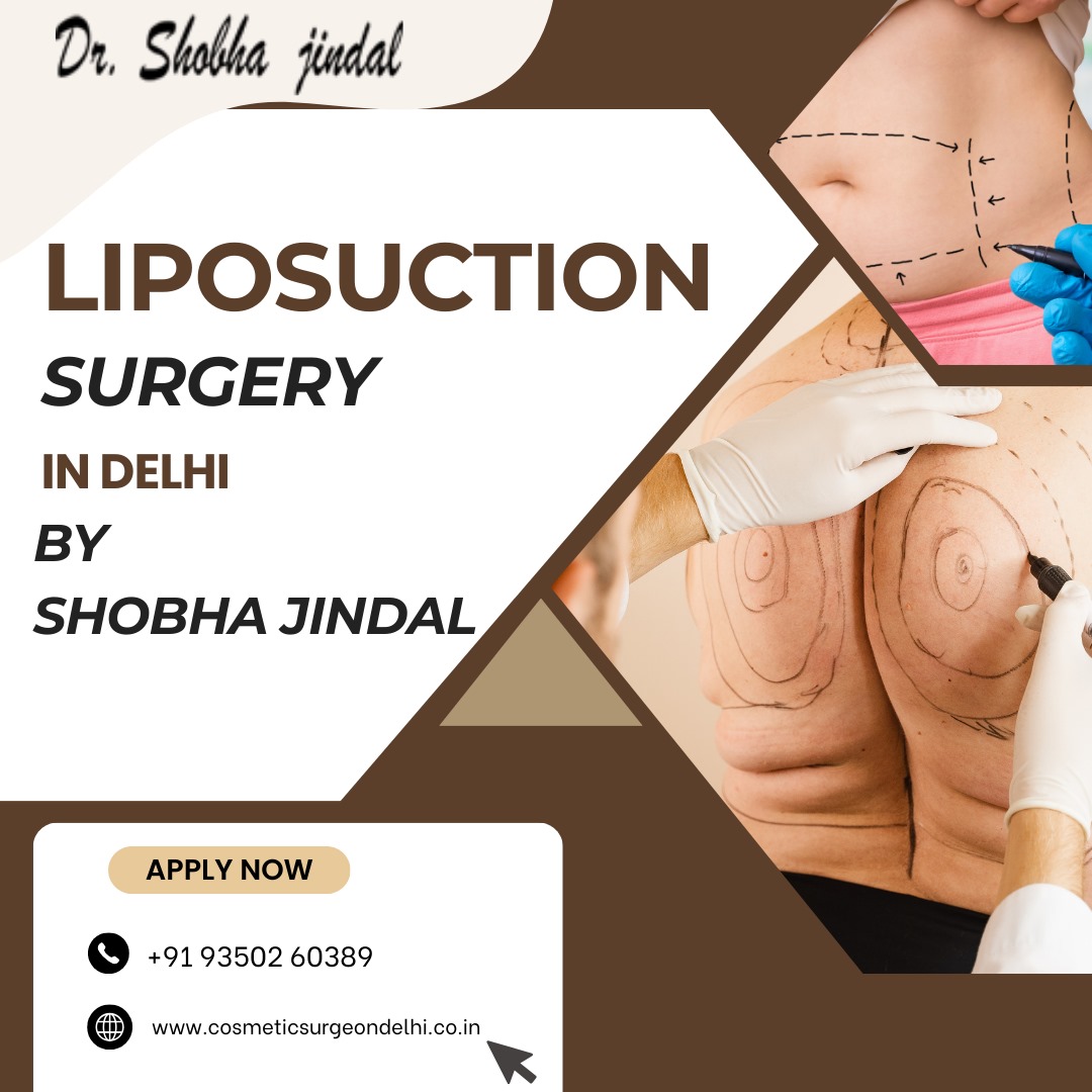 Liposuction Surgery