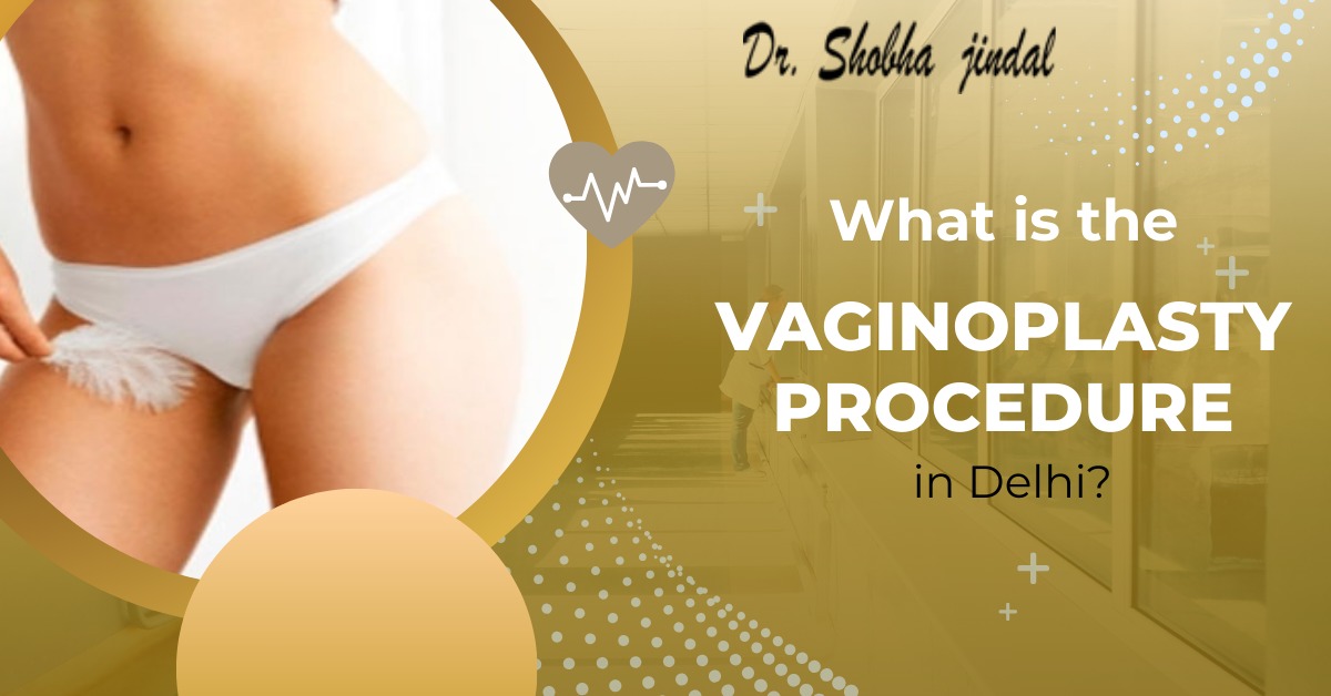 Vaginoplasty procedure