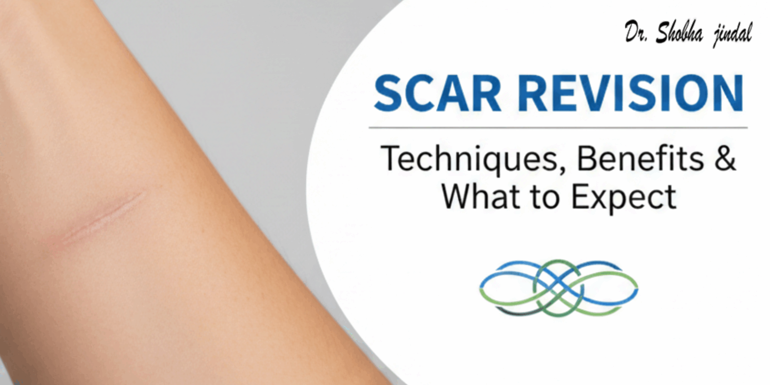 Scar‍‌‍‍‌‍‌‍‍‌ revision