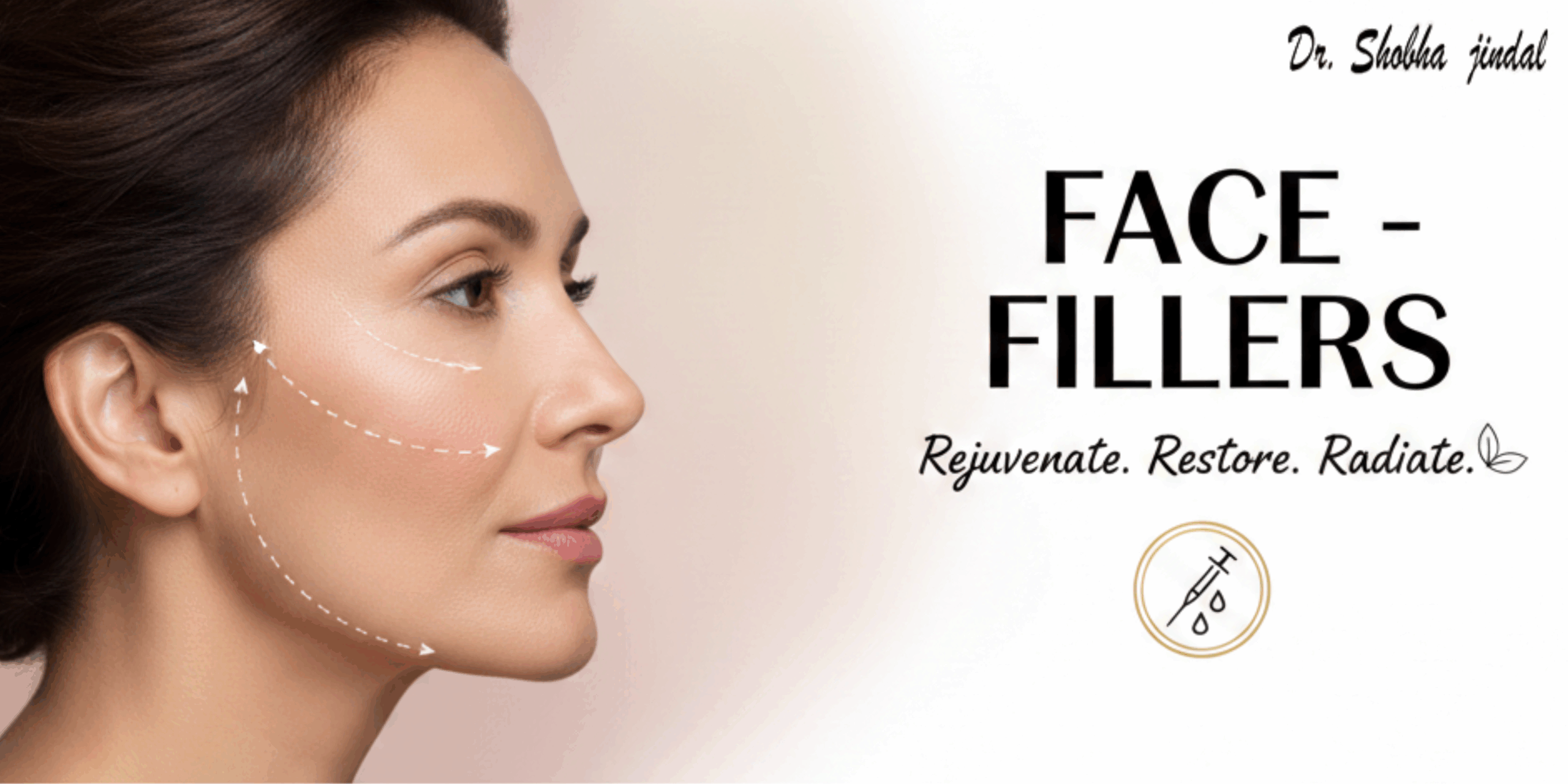Facial fillers