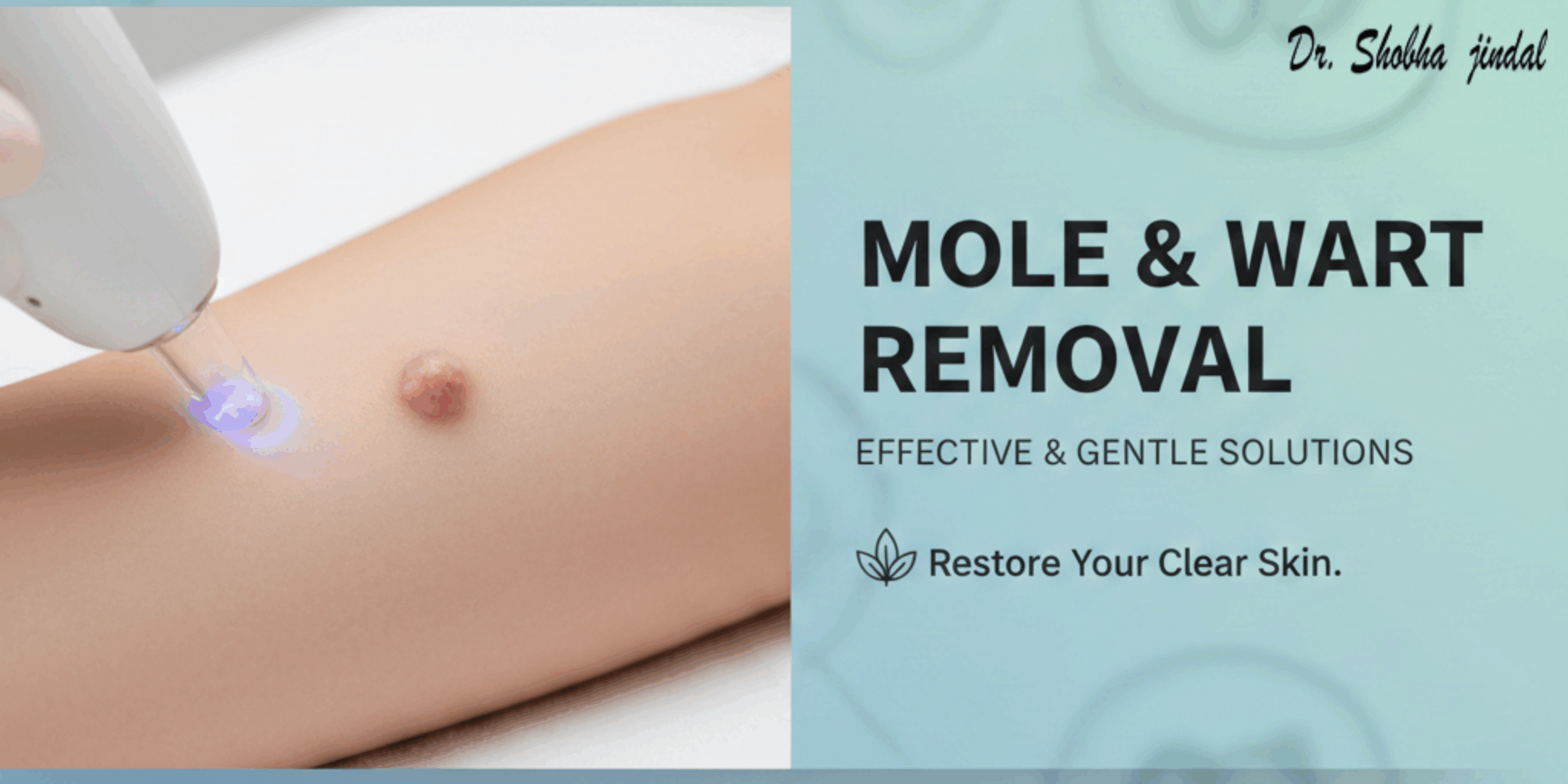 Mole‍‌‍‍‌‍‌‍‍‌ and Wart Removal